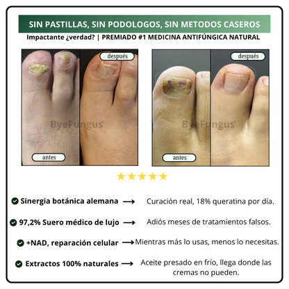 ByeFungus™ – Dile adiós a los hongos y disfruta de unas uñas sanas.