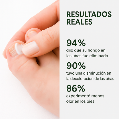 ByeFungus™ – Dile adiós a los hongos y disfruta de unas uñas sanas.