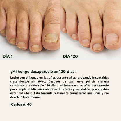 ByeFungus™ – Dile adiós a los hongos y disfruta de unas uñas sanas.