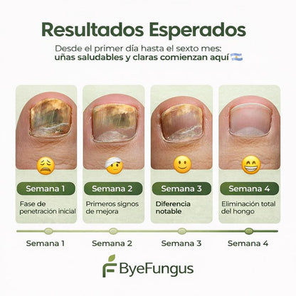 ByeFungus™ – Dile adiós a los hongos y disfruta de unas uñas sanas.